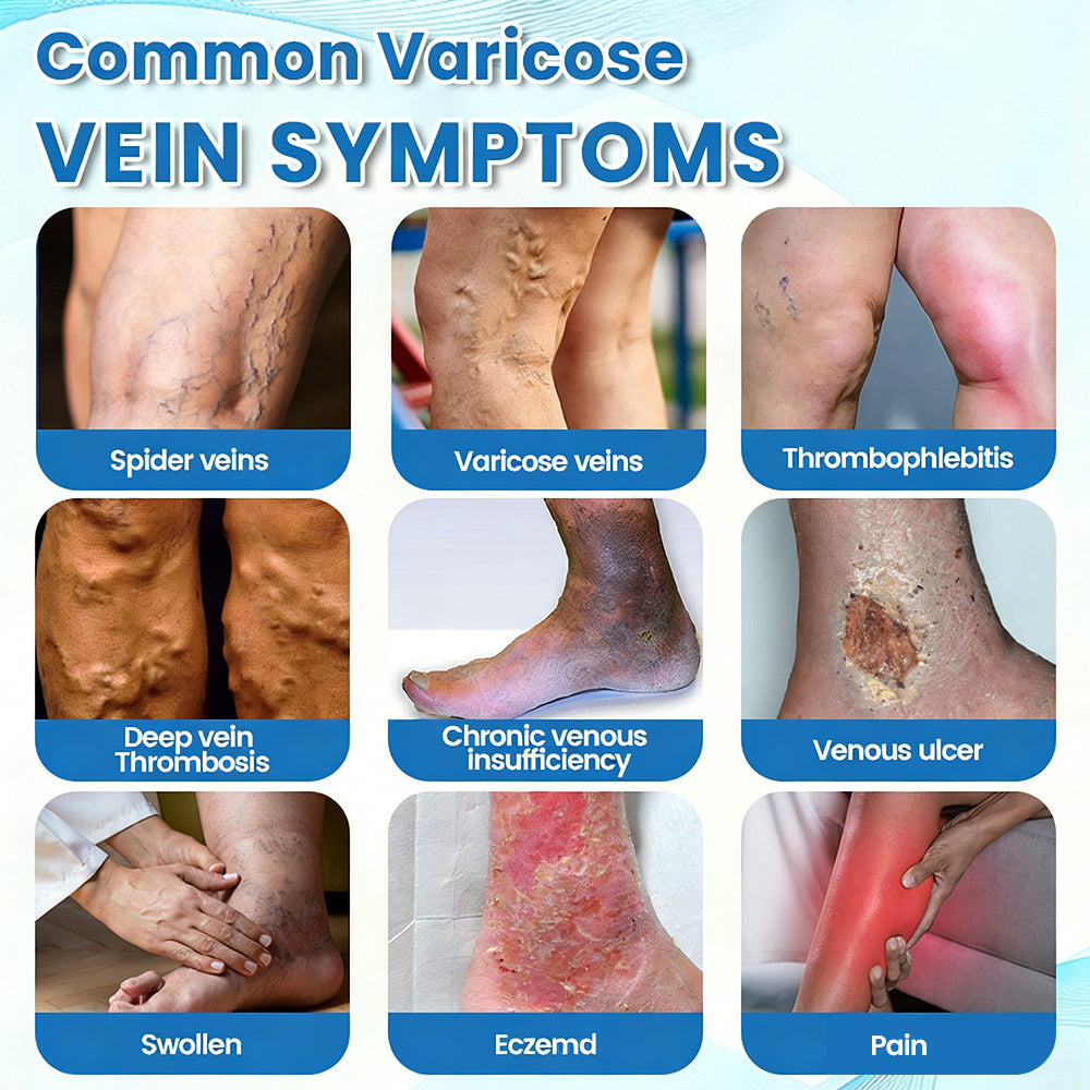 🇺🇸🏆✅🌿GFOUK® VascuCare Vein Healing Spray(Designed for Varicose veins, Spider veins, Deep vein Thrombosis, Chronic venous insufficiency, Venous ulcers, Thrombophlebitis and other venous issues)