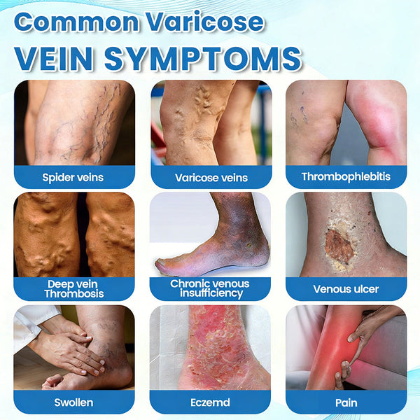 🇺🇸🏆✅🌿GFOUK® VascuCare Vein Healing Spray(Designed for Varicose veins, Spider veins, Deep vein Thrombosis, Chronic venous insufficiency, Venous ulcers, Thrombophlebitis and other venous issues)