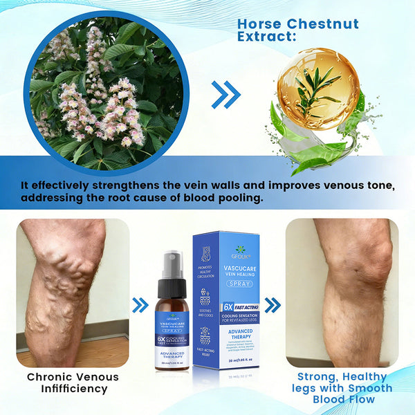 🇺🇸🏆✅🌿GFOUK® VascuCare Vein Healing Spray(Designed for Varicose veins, Spider veins, Deep vein Thrombosis, Chronic venous insufficiency, Venous ulcers, Thrombophlebitis and other venous issues)