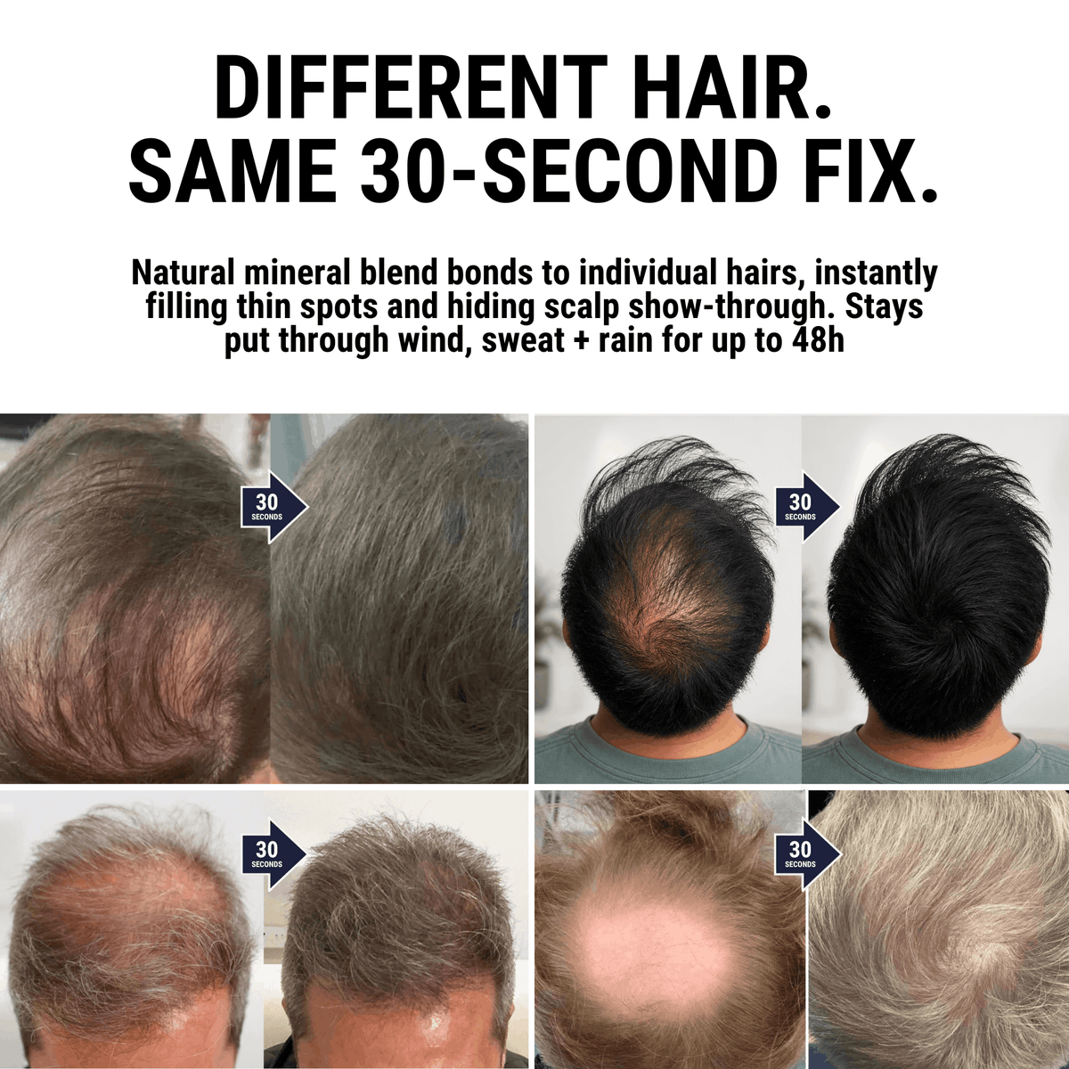 Densiq PRO - Hair Density Filler