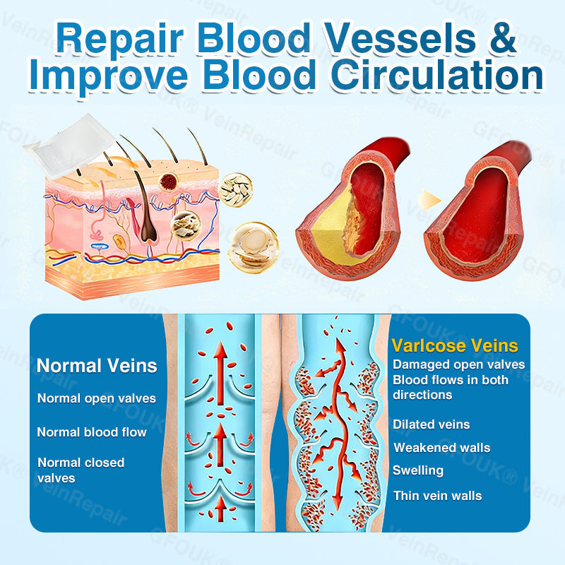 🇬🇧🥇👨‍⚕️⭐GFOUK® VeinRepair Microneedle Patch Roll⚡Instant Relief, Long-Term Results