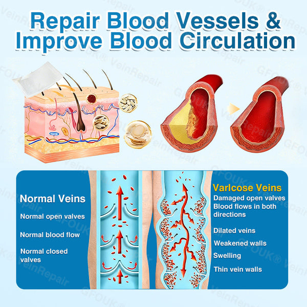 🇬🇧🥇👨‍⚕️⭐GFOUK® VeinRepair Microneedle Patch Roll⚡Instant Relief, Long-Term Results
