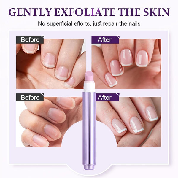 1+1 FREE | GlossBloom™ Nail Nourishment and Strengthening for Lasting Radiance