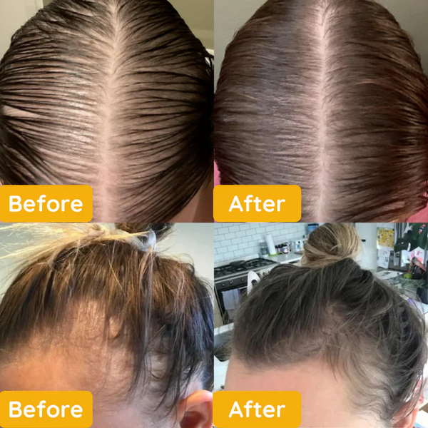 1+1 FREE | Jairy™ Wake Up to Naturally Thicker, Stronger Hair