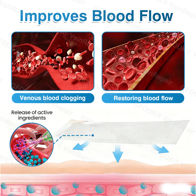 🇬🇧🥇👨‍⚕️⭐GFOUK® VeinRepair Microneedle Patch Roll⚡Instant Relief, Long-Term Results