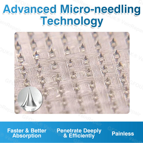 🇬🇧🥇👨‍⚕️⭐GFOUK® VeinRepair Microneedle Patch Roll⚡Instant Relief, Long-Term Results
