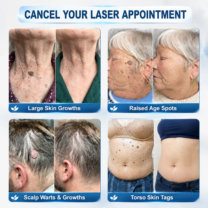 DermaRollix™ Skin Spot Removal Roller