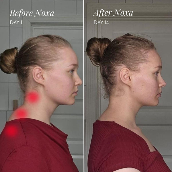 NeckRelief™ Deep-Kneading Neck & Shoulder Massager