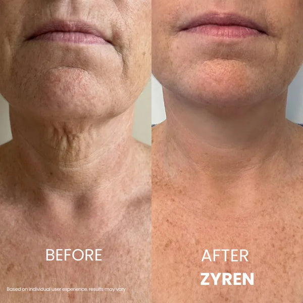 Zyren Tighten & Lift Neck Cream