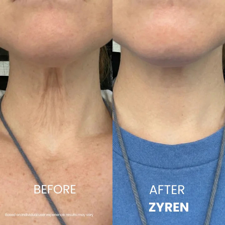 Zyren Tighten & Lift Neck Cream