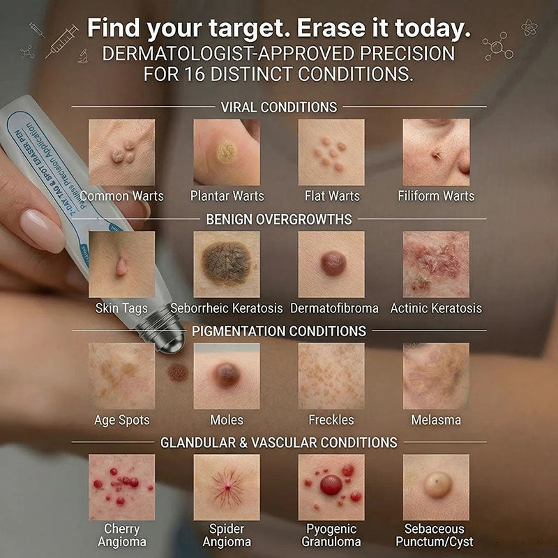 DermaRollix™ Skin Spot Removal Roller