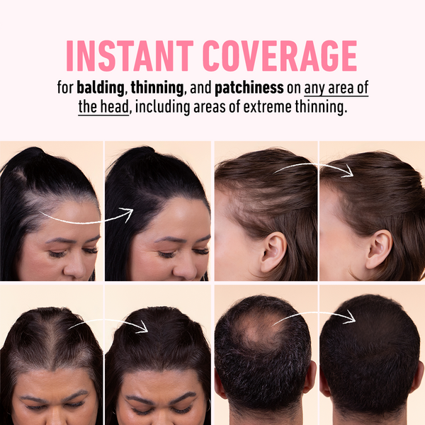 Boldify™ Hairline Powder | Instant Fuller Hair in Seconds