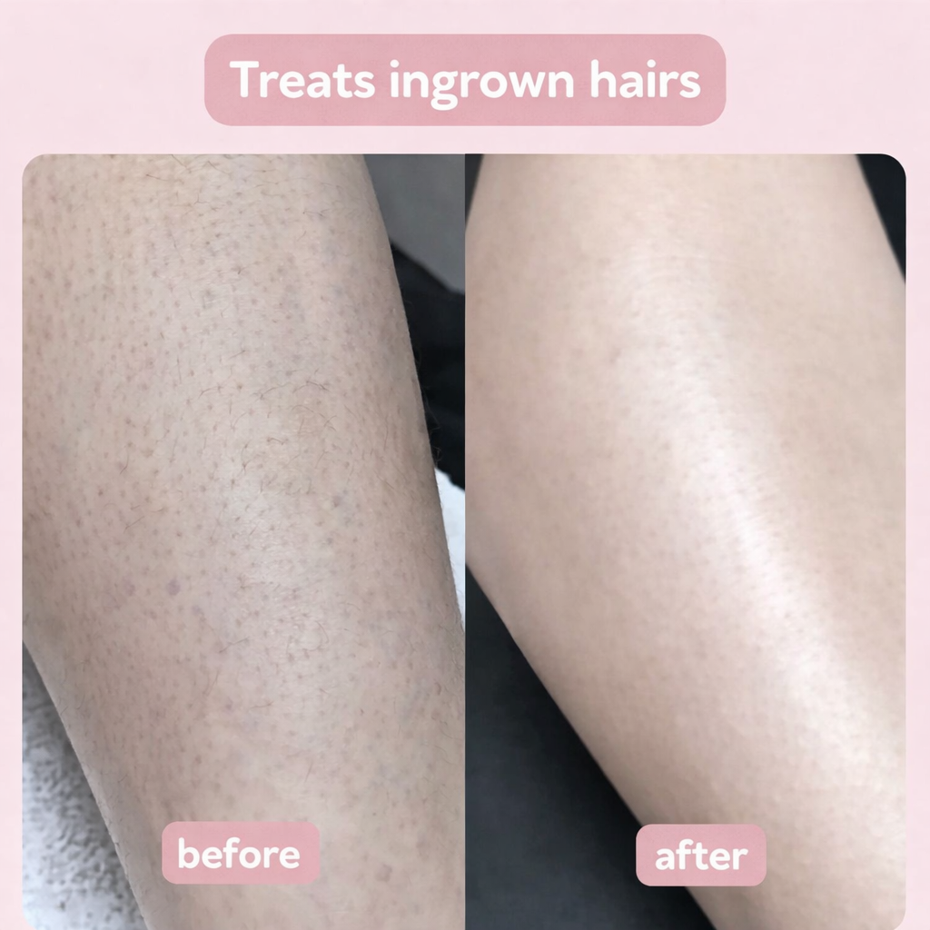 MyNova™ 2-in-1 Body Shaver | Smooth Skin, Effortless Care