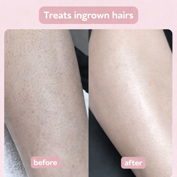 MyNova™ 2-in-1 Body Shaver | Smooth Skin, Effortless Care