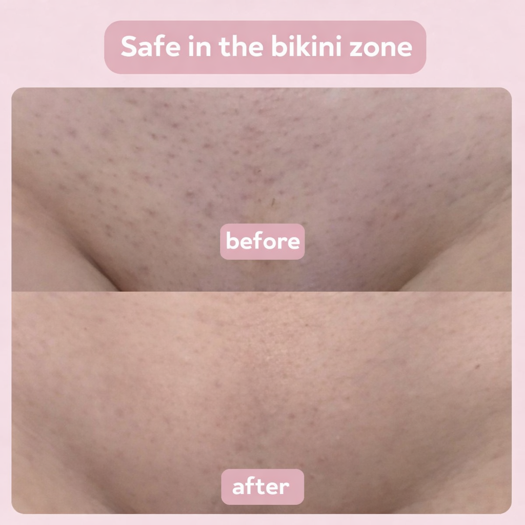 MyNova™ 2-in-1 Body Shaver | Smooth Skin, Effortless Care