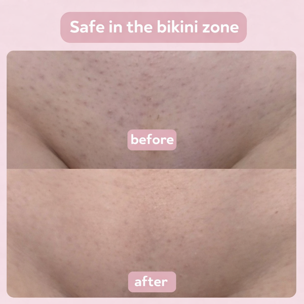 MyNova™ 2-in-1 Body Shaver | Smooth Skin, Effortless Care
