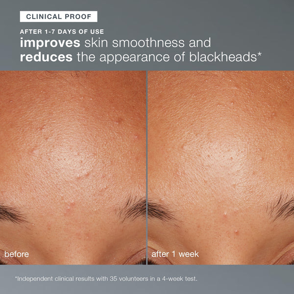 Daily Microfoliant Exfoliator