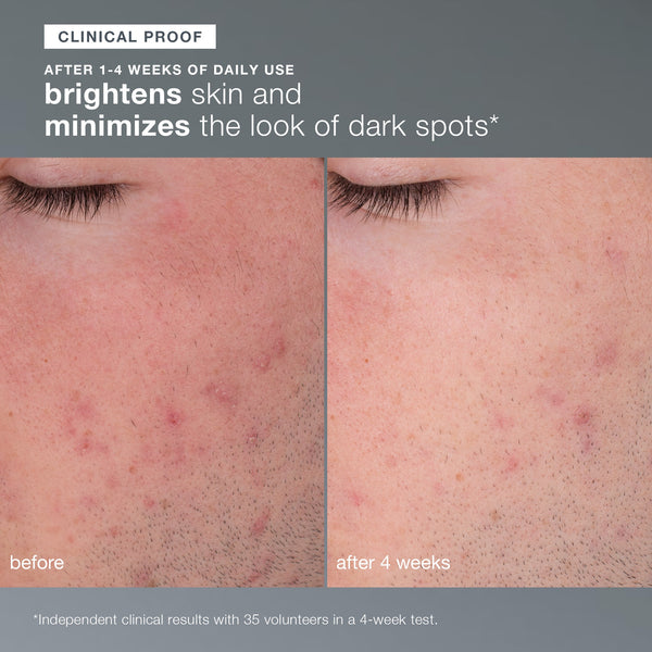 Daily Microfoliant Exfoliator