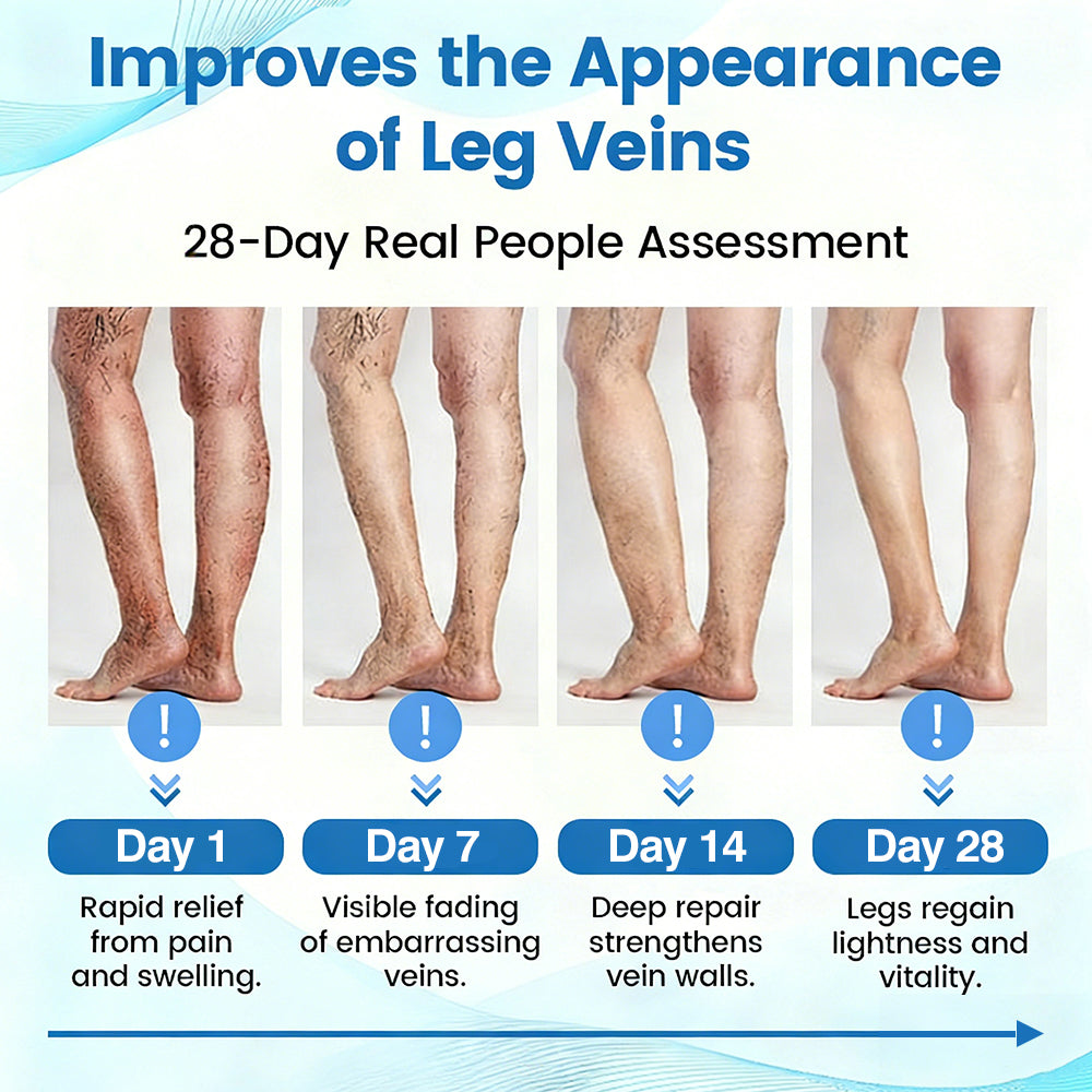 🇺🇸🏆✅🌿GFOUK® VascuCare Vein Healing Spray(Designed for Varicose veins, Spider veins, Deep vein Thrombosis, Chronic venous insufficiency, Venous ulcers, Thrombophlebitis and other venous issues)