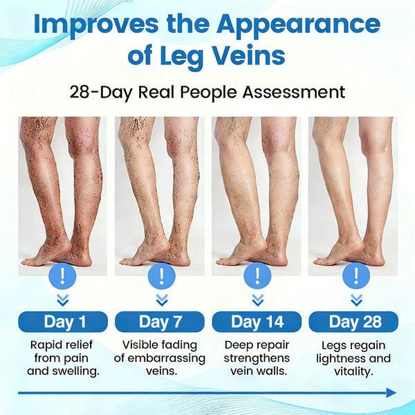 🇺🇸🏆✅🌿GFOUK® VascuCare Vein Healing Spray(Designed for Varicose veins, Spider veins, Deep vein Thrombosis, Chronic venous insufficiency, Venous ulcers, Thrombophlebitis and other venous issues)