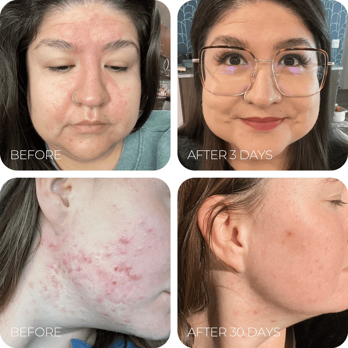 Puregraze™ Tallow Repair Cream