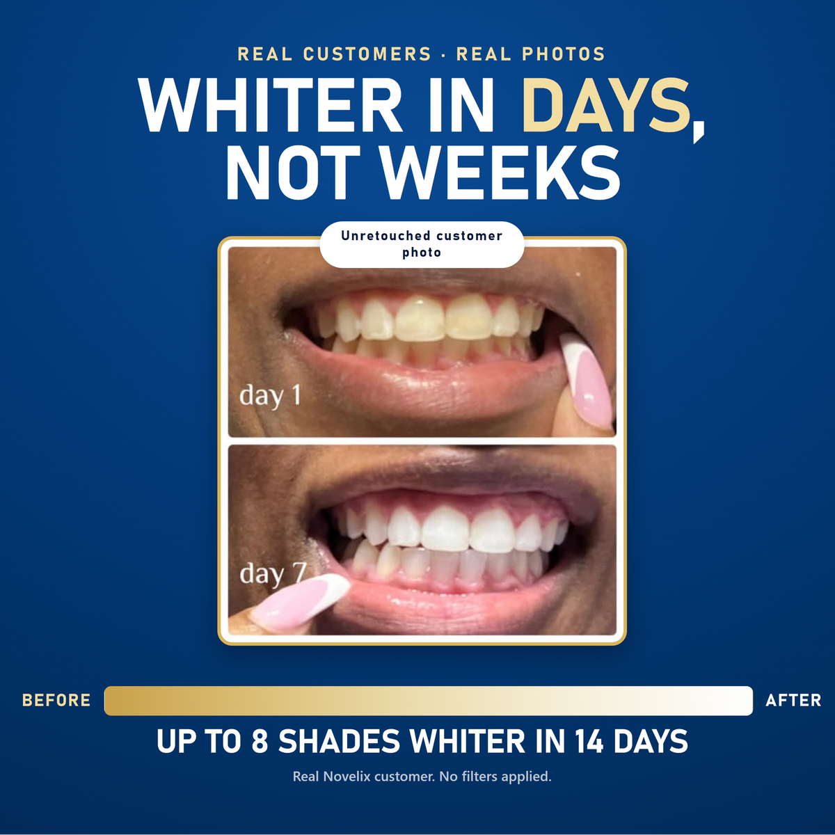 PearlBright™ Precision Teeth Whitening Pen