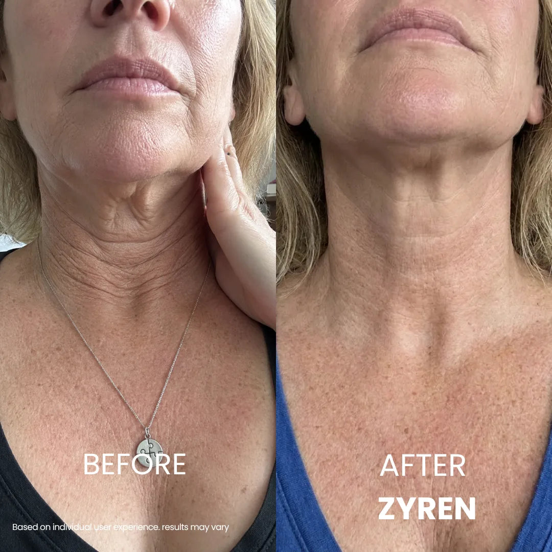 Zyren Tighten & Lift Neck Cream