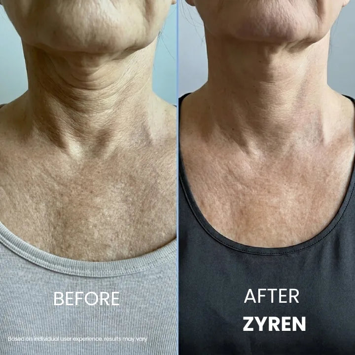 Zyren Tighten & Lift Neck Cream