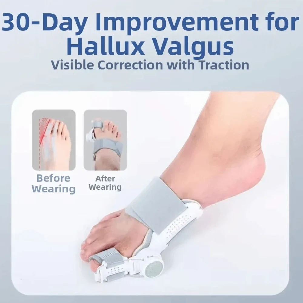 Bunion Corrector Supports Natural Toe Alignment for Comfort