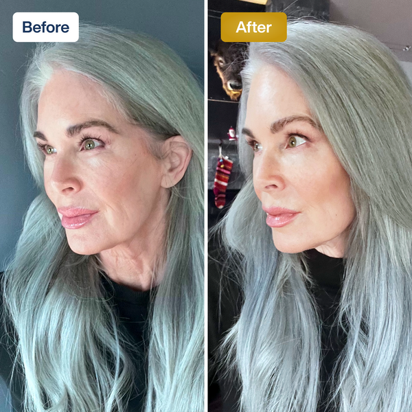SkinKlean™ Baby Collagen Mask | Glass Skin in Just Hours