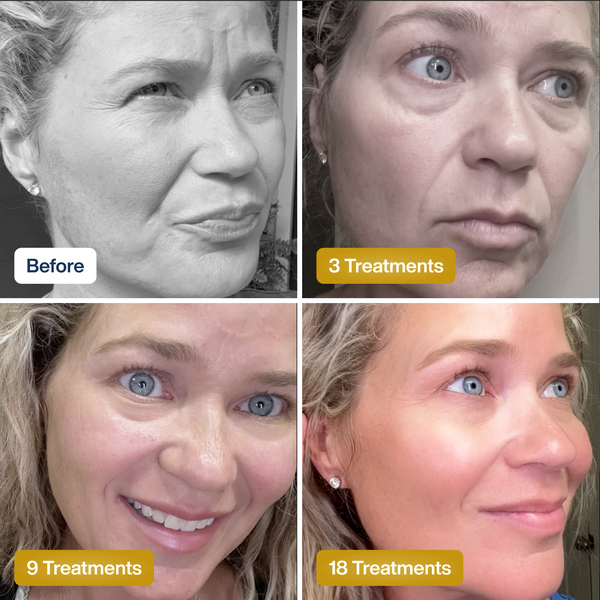 SkinKlean™ Baby Collagen Mask | Glass Skin in Just Hours