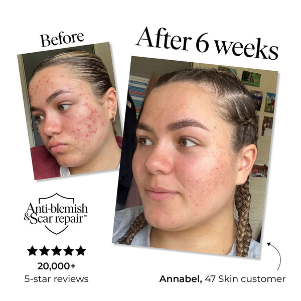 DermaLume™ Skin Recovery Serum