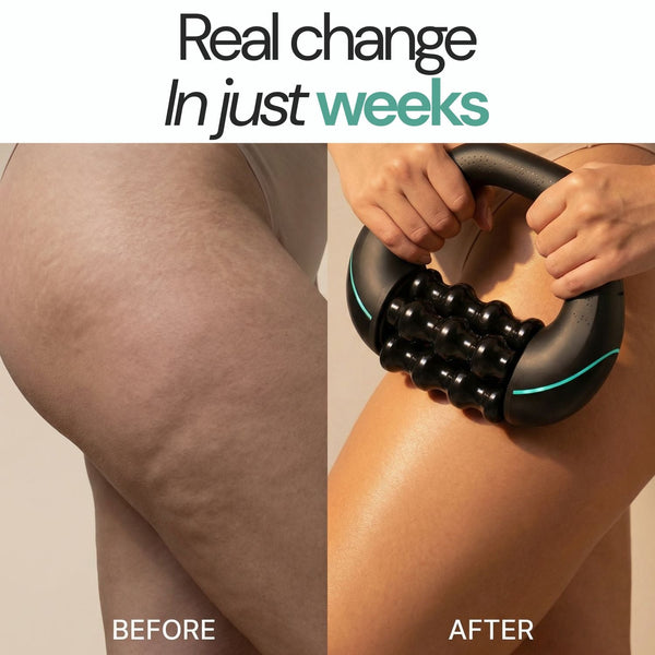 Neurothlet™ RollShaper | Smoother Firmer Skin in Just 4 Weeks
