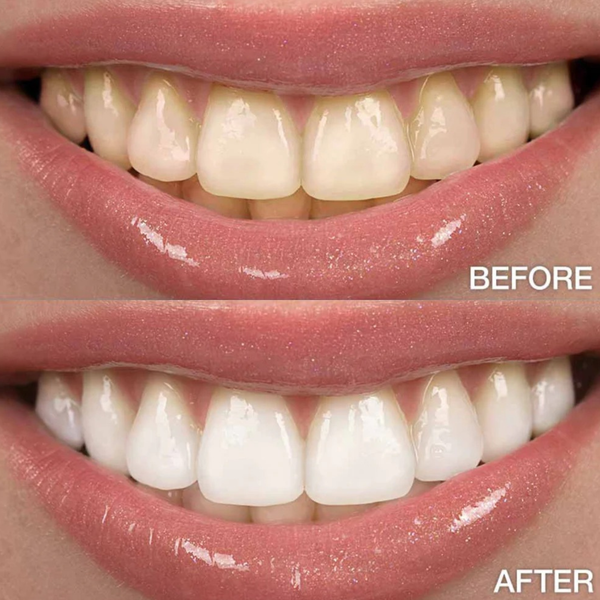 Luvra™ Toothpaste