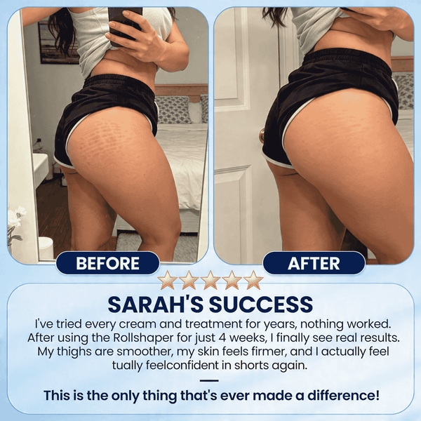 Neurothlet™ RollShaper | Smoother Firmer Skin in Just 4 Weeks