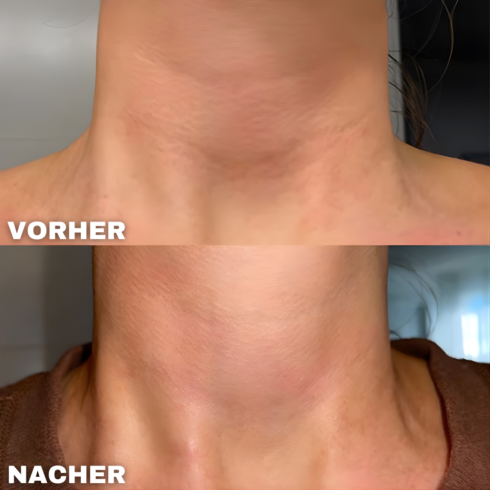 DermalGlow™ - Wake Up to Smooth, Hydrated Neck Skin Overnight