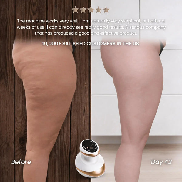 Celluviaa – Smooth Skin in 14 Days
