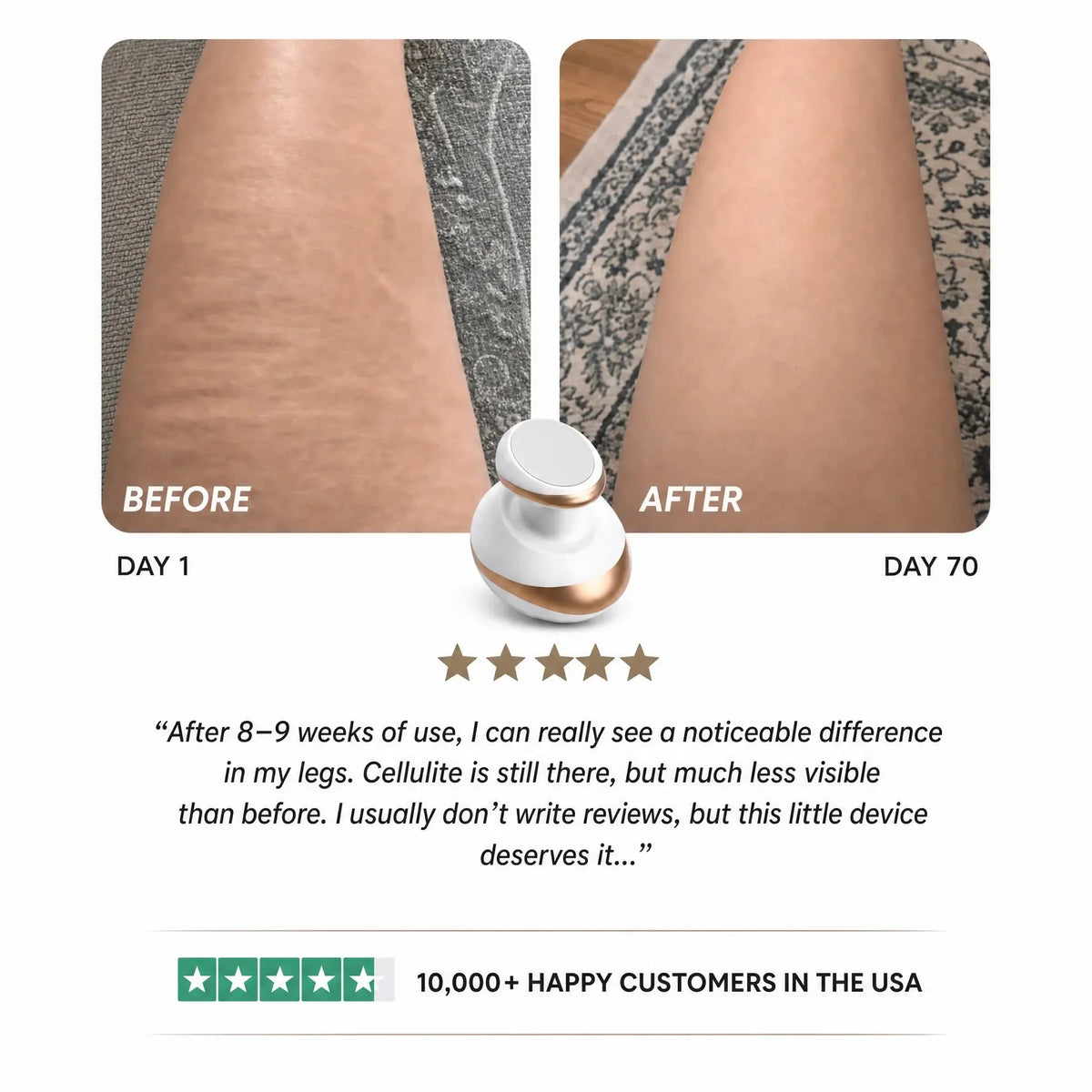 Celluviaa – Smooth Skin in 14 Days