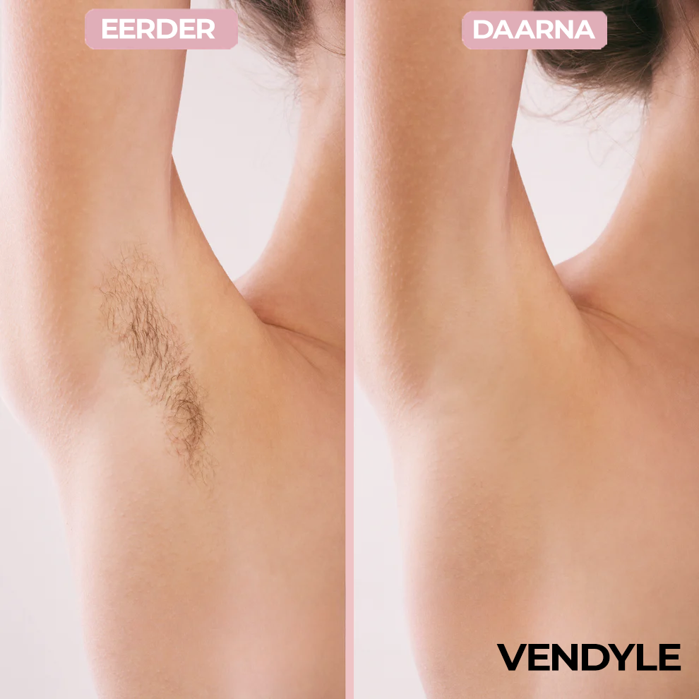 Vendyle 2-in-1 Body Razor for Smooth, Irritation-Free Shaving