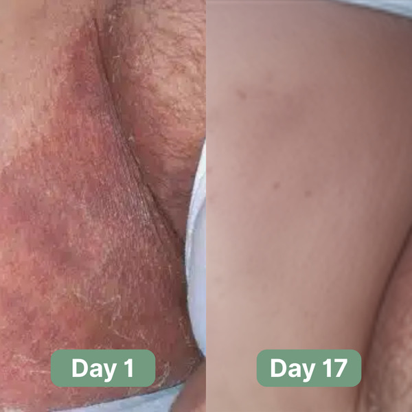 Veloma Antifungal Soap®