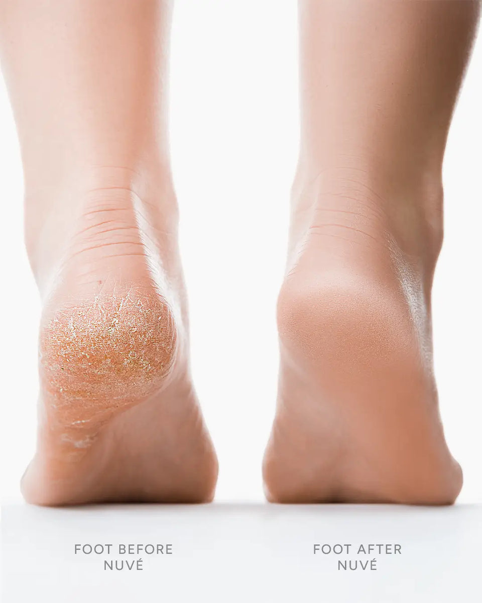 Nuvé™ Silk Pro | Smooth Feet in Minutes